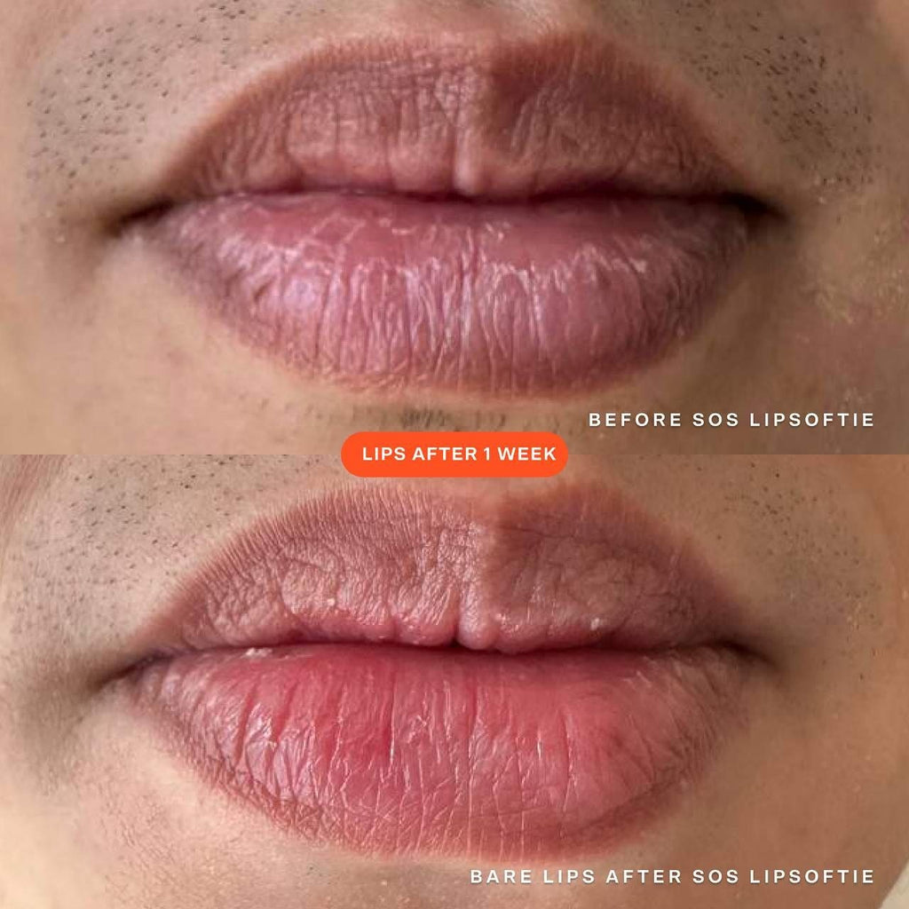 علاج الشفاه Tower 28 LipSoftie
