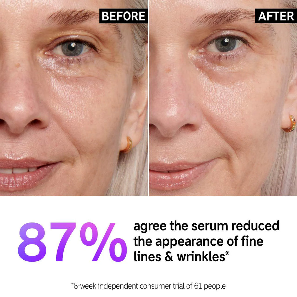 سيروم الخطوط الدقيقة والتجاعيد من INKEY List Retinol