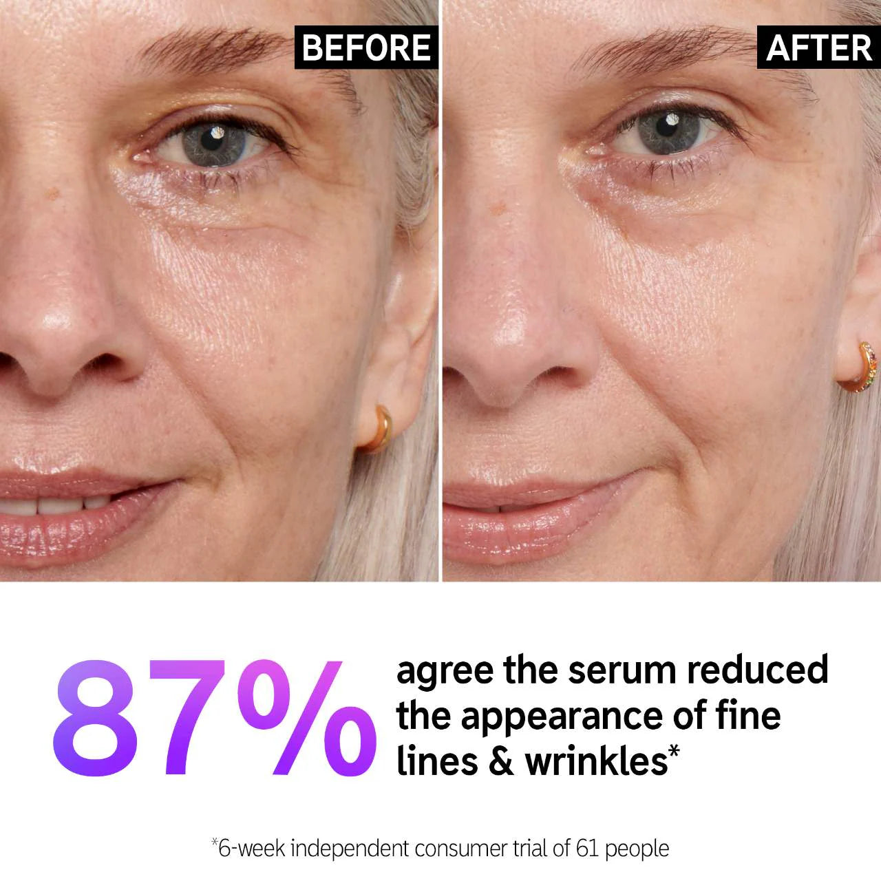 سيروم الخطوط الدقيقة والتجاعيد من INKEY List Retinol
