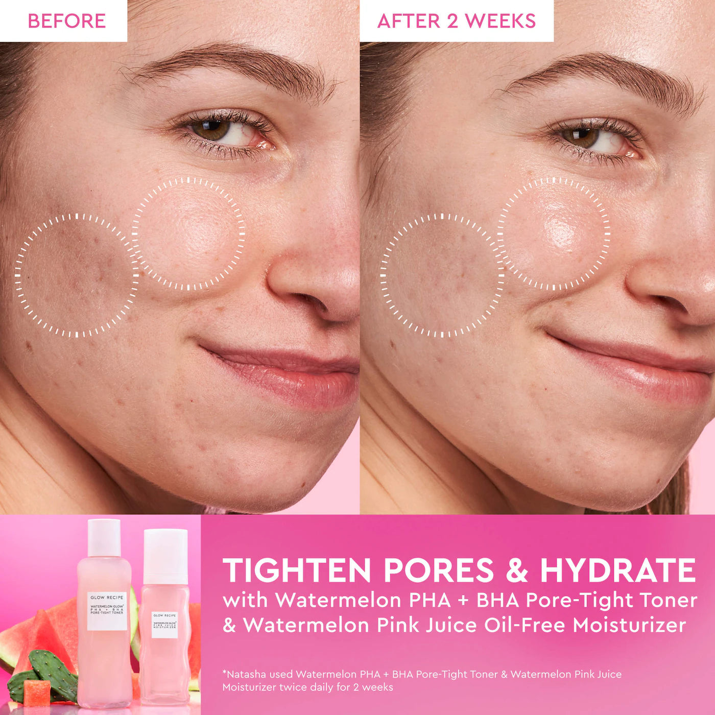 Glow Recipe Watermelon Pink Juice Oil-Free Moisturizer