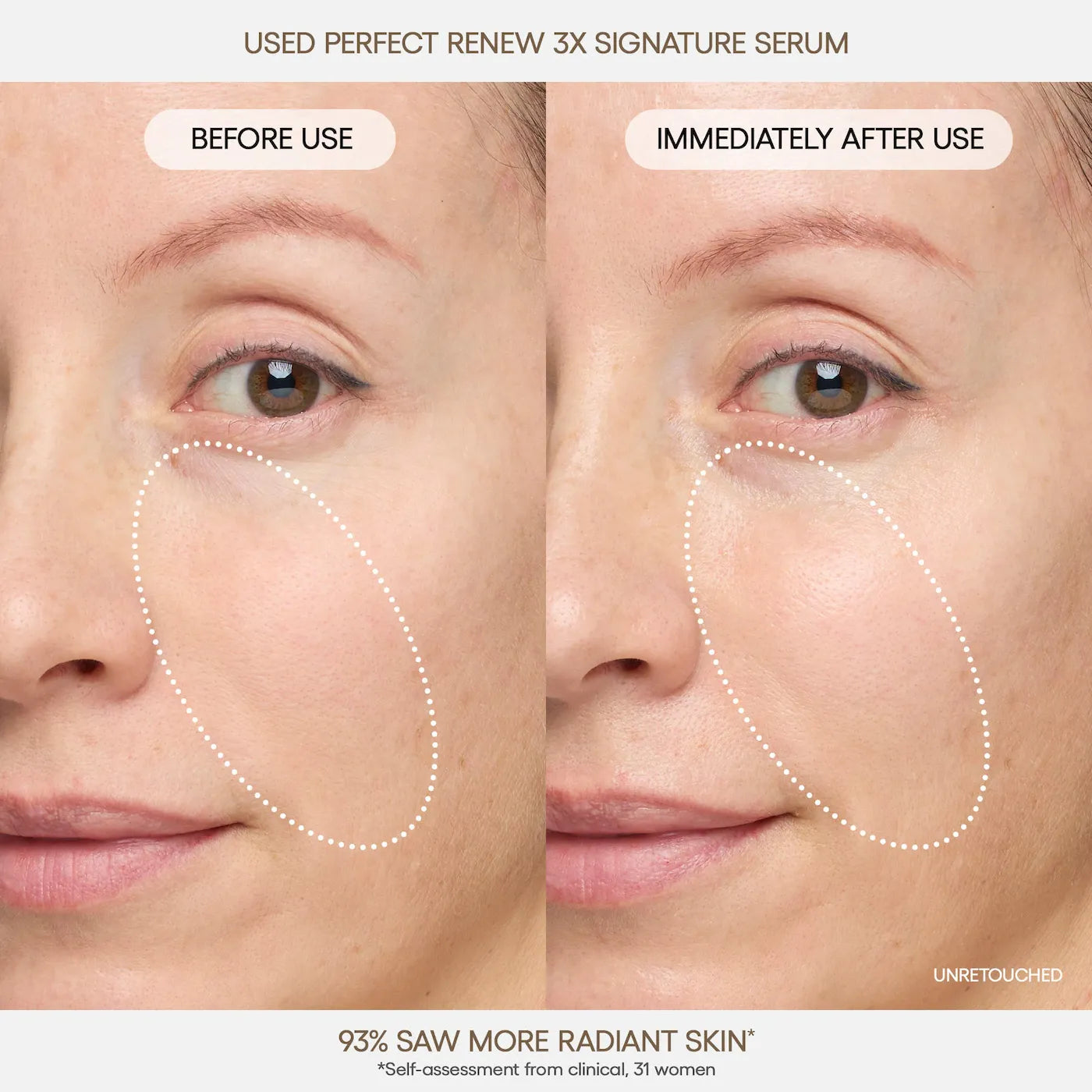 LANEIGE Perfect Renew 3x Signature Serum Advanced for Anti-Aging, Firming & Lifting