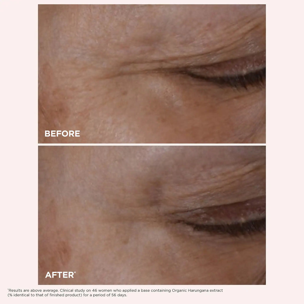Clarins Total Eye Lift Eye Cream for Firming, Wrinkles, Dark Circles & Puffiness