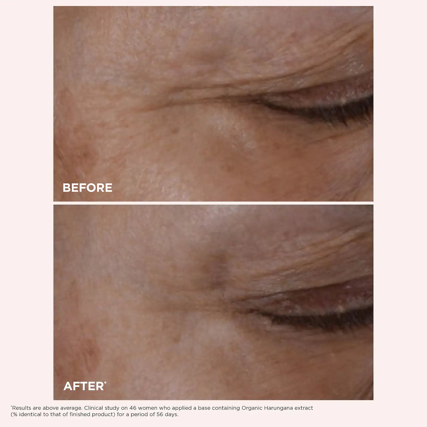 Clarins Total Eye Lift Eye Cream for Firming, Wrinkles, Dark Circles & Puffiness