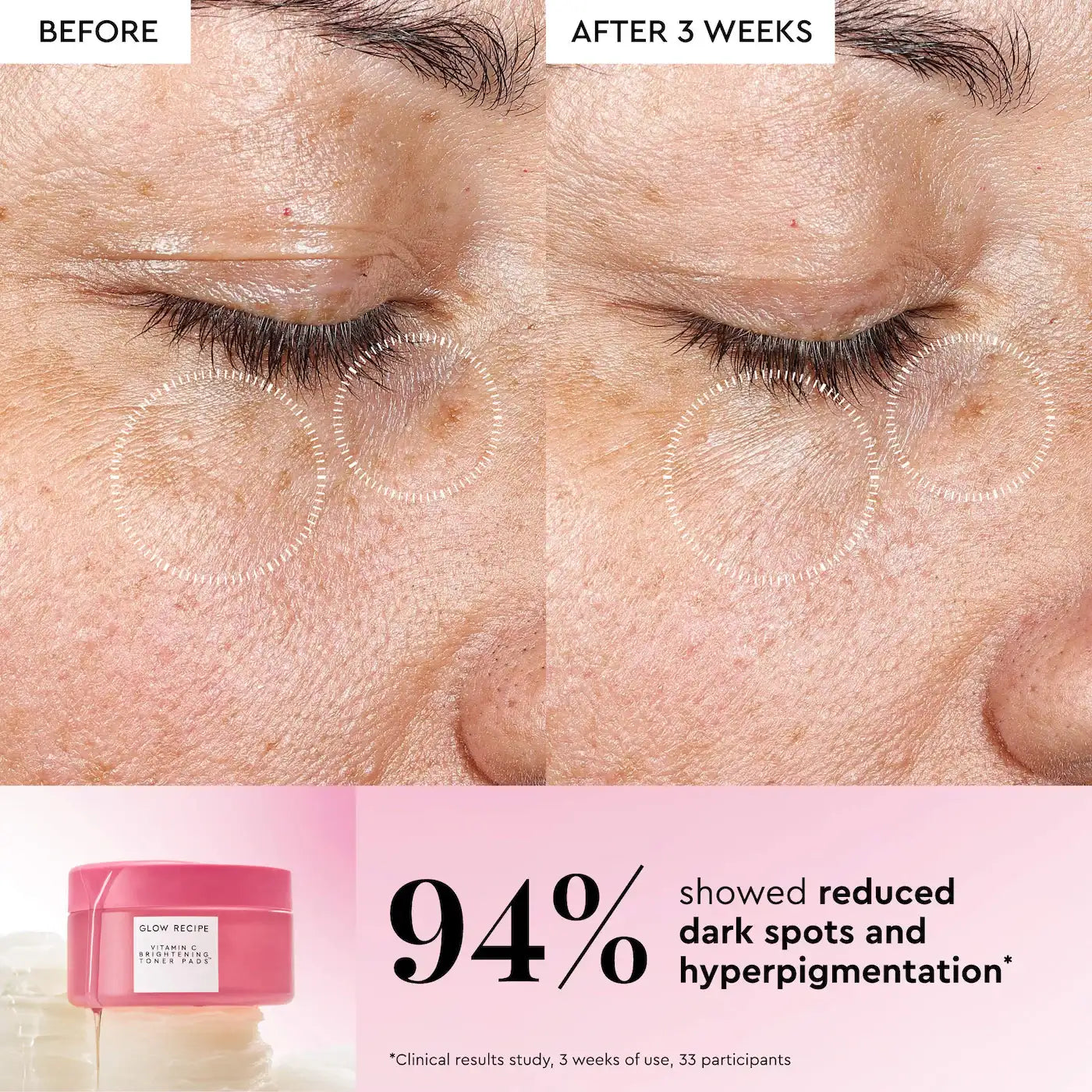 Glow Recipe Vitamin C Brightening Korean Guava Toner Pads for Undereye & Cheeks