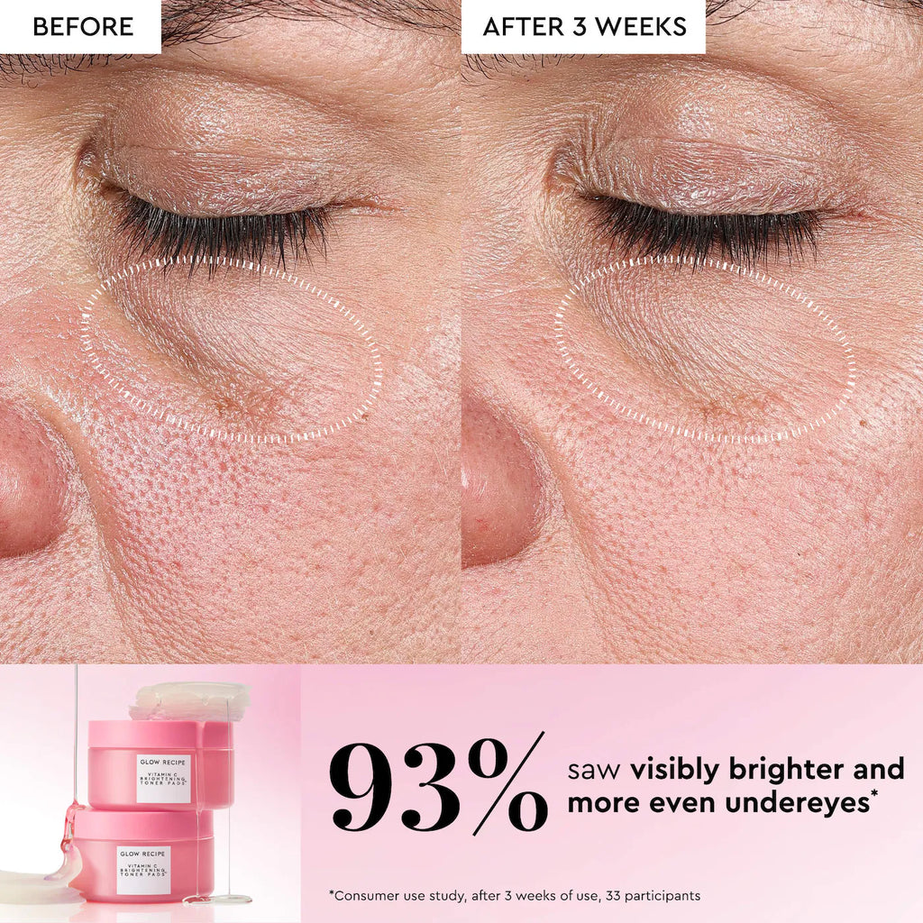 Glow Recipe Vitamin C Brightening Korean Guava Toner Pads for Undereye & Cheeks