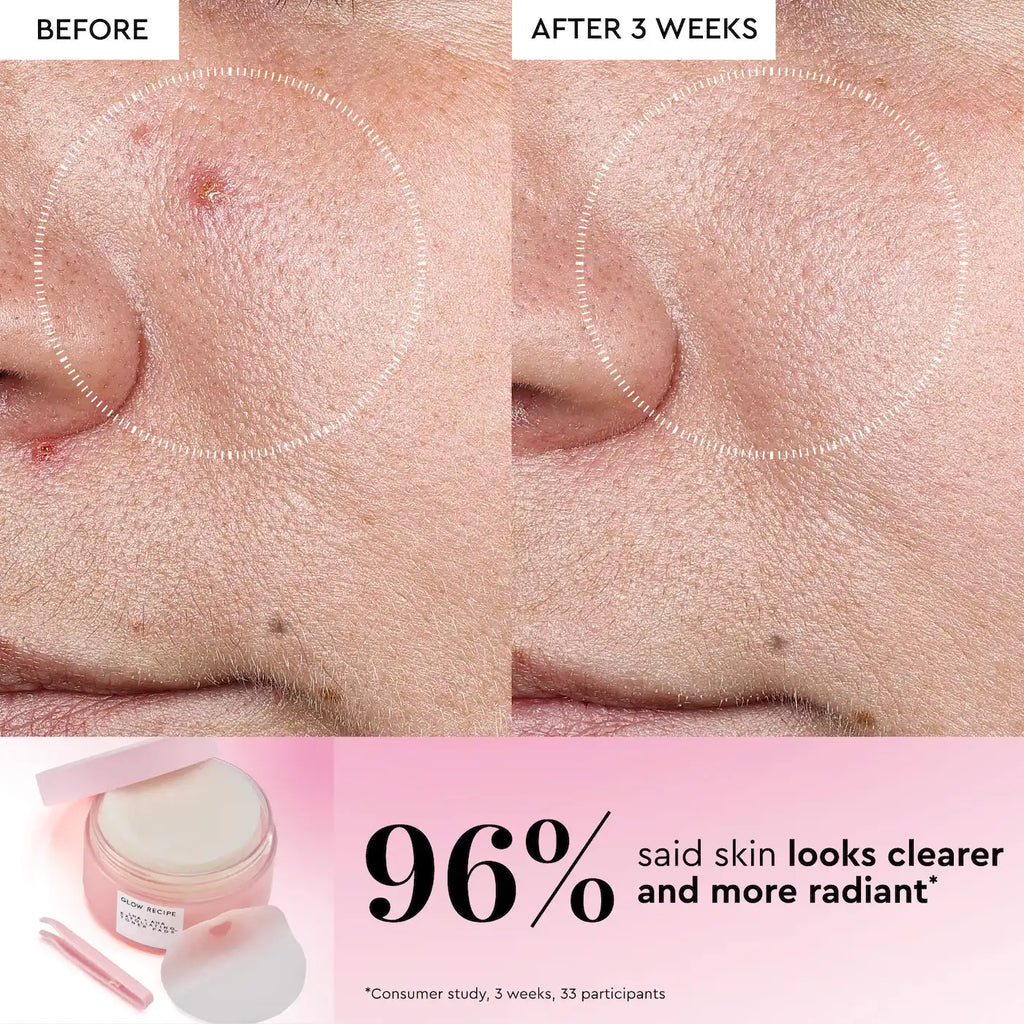 Glow Recipe LHA + AHA Korean Watermelon Toner Pads for Hydration and Gentle Exfoliation
